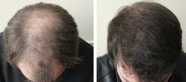 Keratinorm cápsulas - Image 3